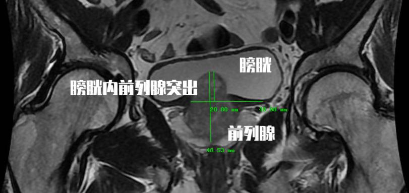 我来教大家！麻友圈2麻将助赢神器(赢的技巧提高胜率)