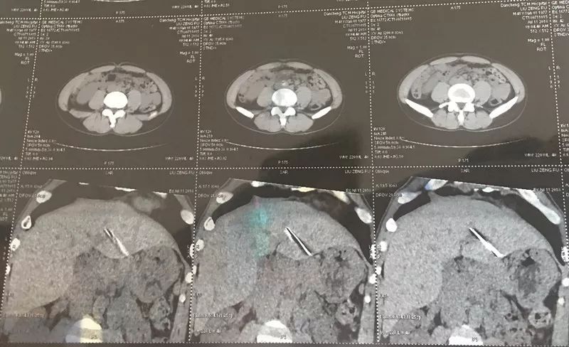 给大家爆料一下X光可以提前知道普通金属暗宝吗《详细教程 新浪科技》
